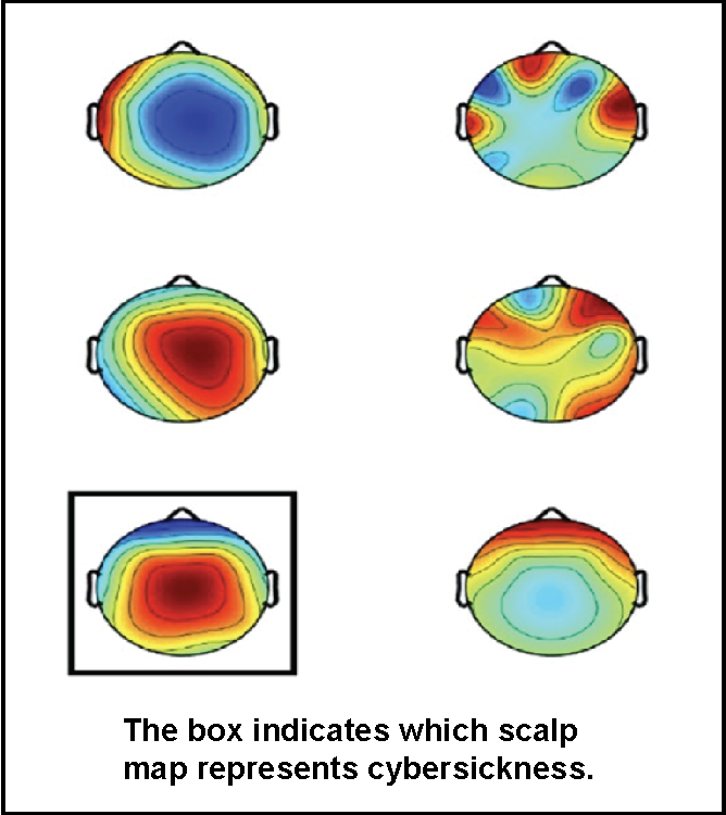 scalp map