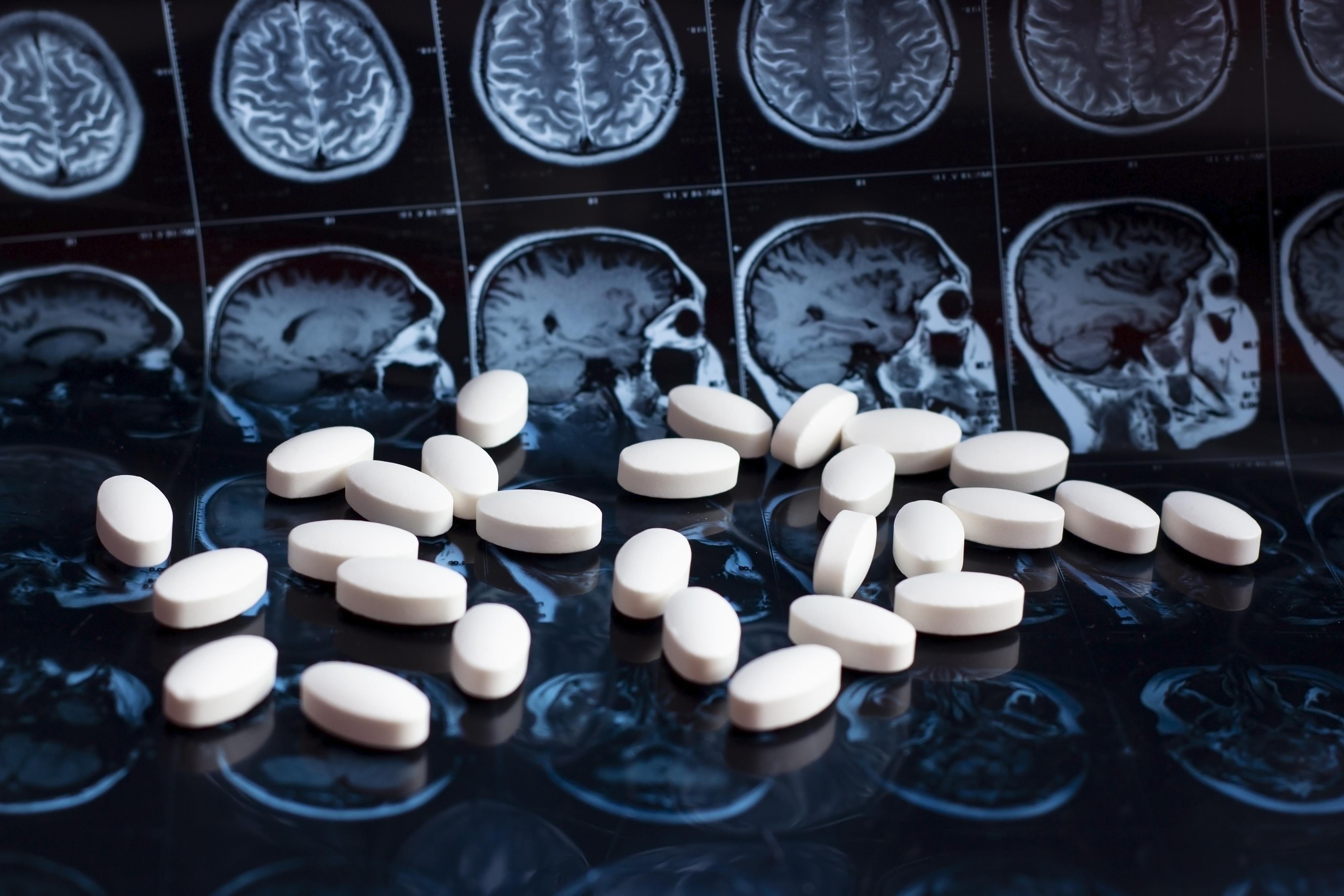 White pharmaceutical medicine pills on magnetic brain resonance scan mri background.